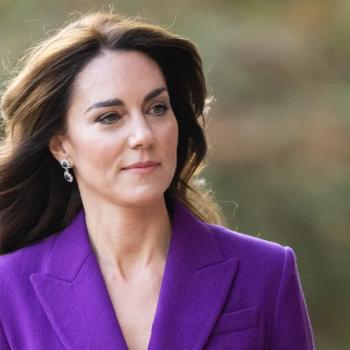 Что происходит с герцогиней Кейт? «Они переживают ад с Уильямом». Таблоид пишет о побочных эффектах химиотерапии