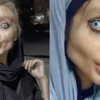 Она перенесла 50 операций и похудела на 40 кг, чтобы стать похожей на Анджелину Джоли. В итоге оказалась в иранской тюрьме