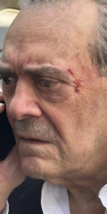 Актер напал на 79-летнего “короля папарацци”