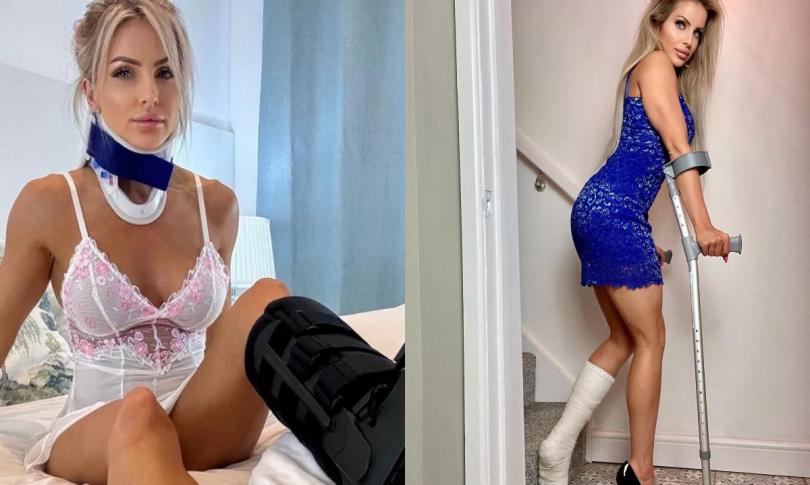 Модель симулирует переломы и зарабатывает кучу денег