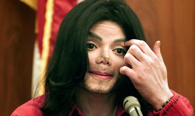 Загадочные шрамы Майкла Джексона.