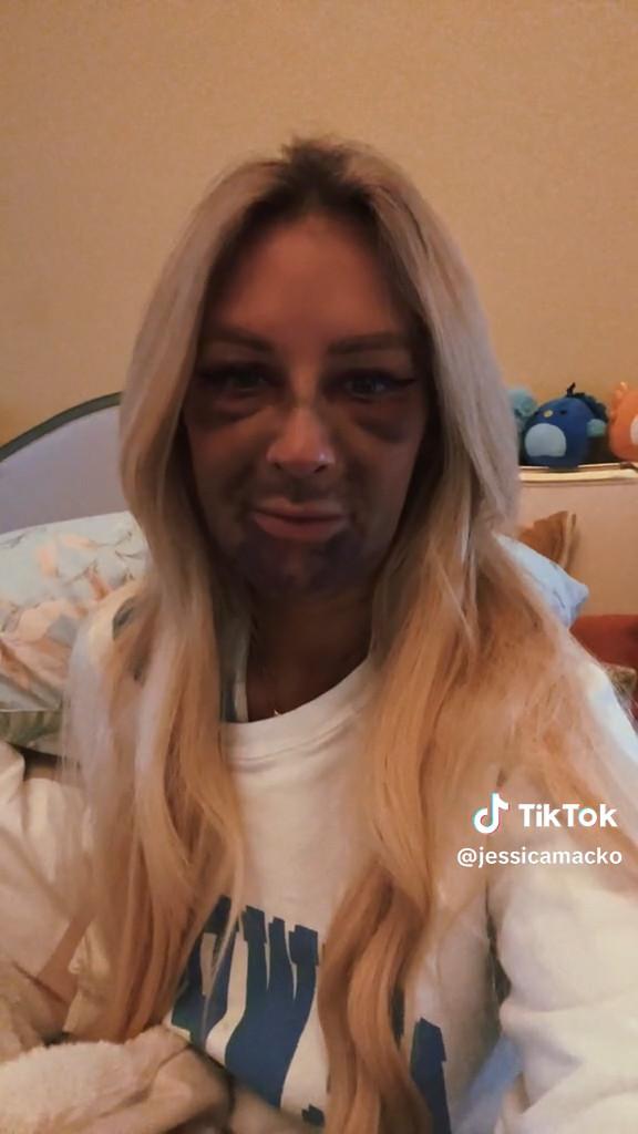 Джессика Мако исправила зубы и пережила настоящий кошмар. Несмотря на это, он ни о чём не жалеет