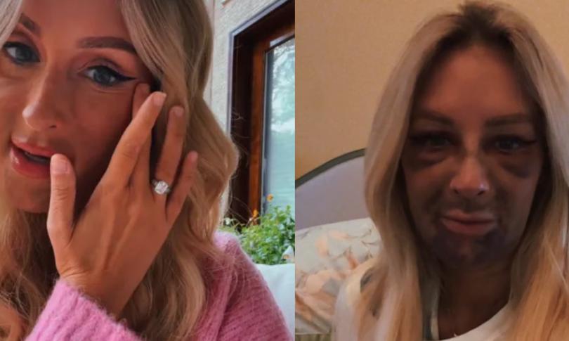 Джессика Мако исправила зубы и пережила настоящий кошмар. Несмотря на это, он ни о чём не жалеет