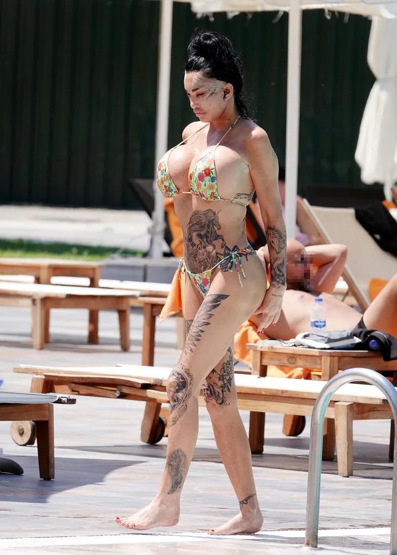 Кэти Прайс после операции