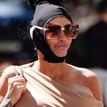 Кэти Прайс, у которой были долги и недавно арестована, сняла повязки и продемонстрировала результаты