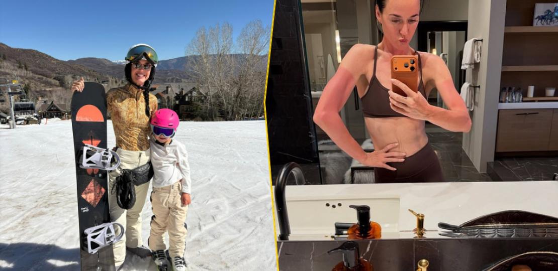 Кэти Перри показала солнечный ожог после лыжной поездки с дочерью